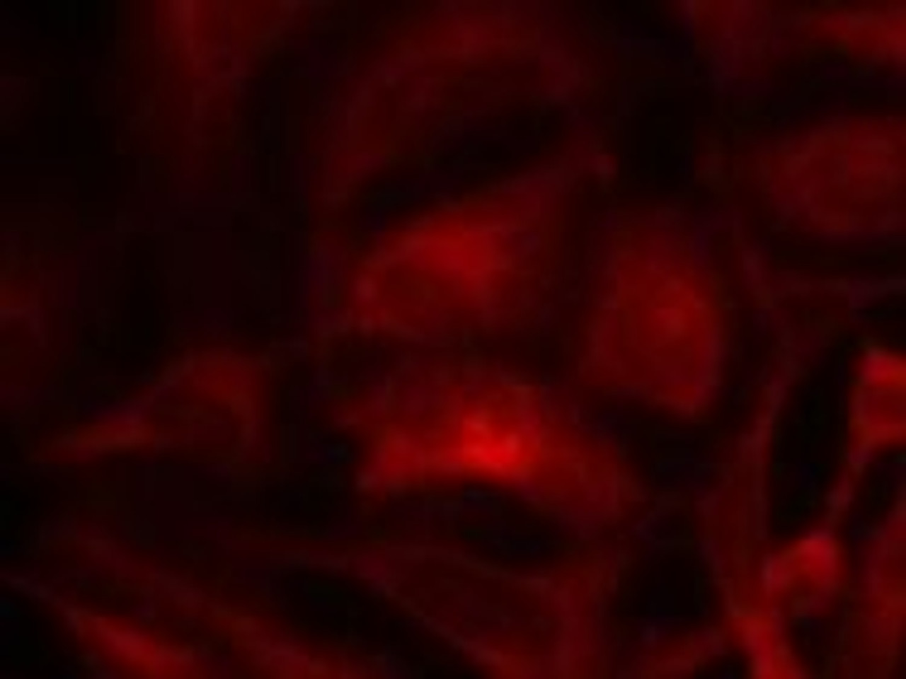 Immunofluorescence staining of methanol-fixed HeLa cells using Rac1 (Ab-71) .