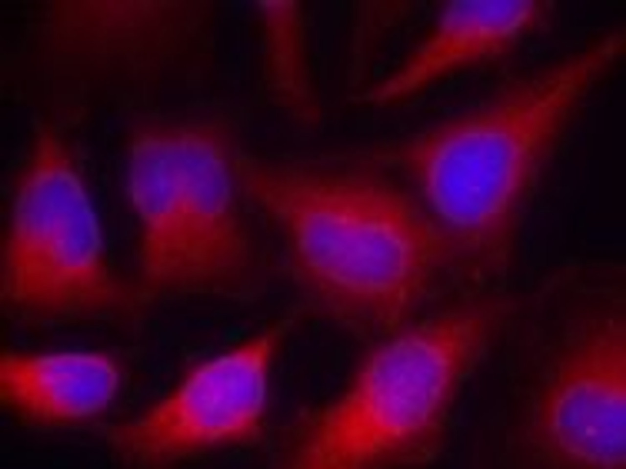 Immunofluorescence staining of methanol-fixed HeLa cells using VASP (Ab-157) .