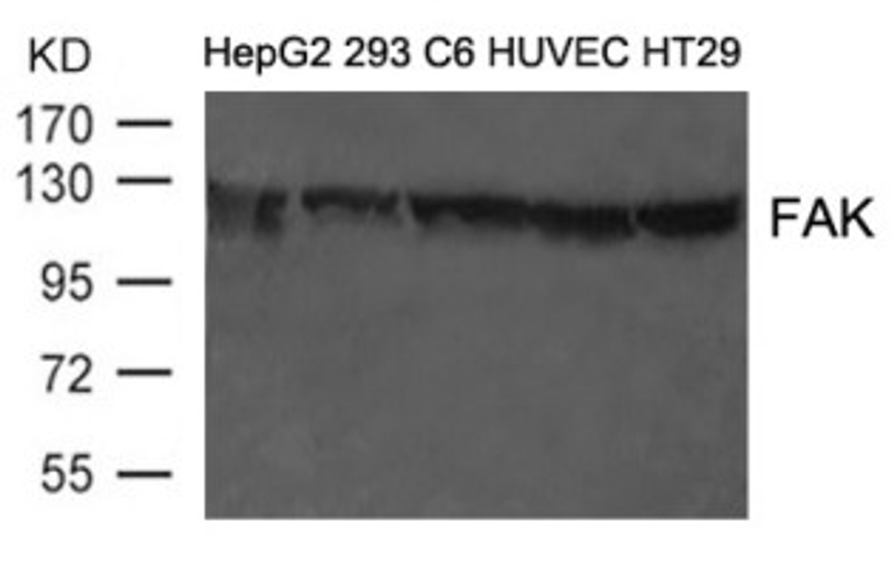 Western blot analysis of extract from HepG2, 293, C6, HUVEC and HT29 cells using FAK (Ab-397) .