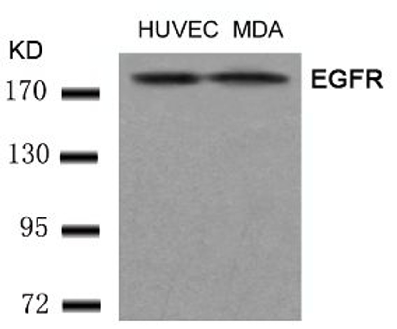 Western blot analysis of lysed extracts from HUVEC and MDA cells using EGFR (Ab-1197) .