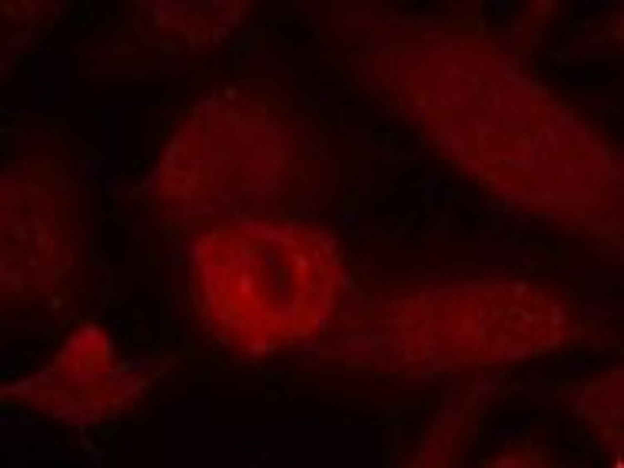 Immunofluorescence staining of methanol-fixed HeLa cells using IRS-1 (Ab-639) .