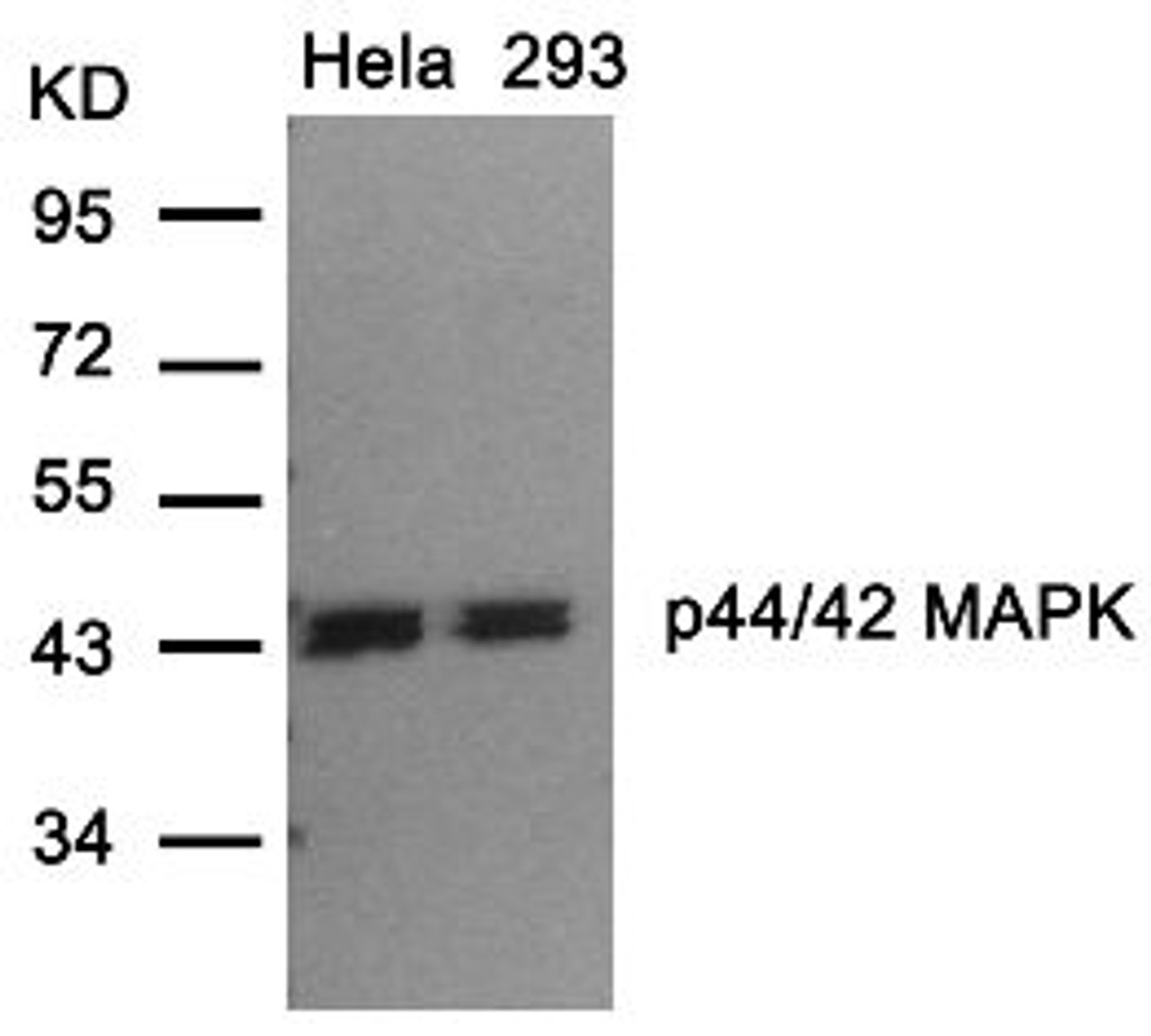 Western blot analysis of lysed extracts from HeLa and 293 cells using p44/42 MAP Kinase (Ab-202) .