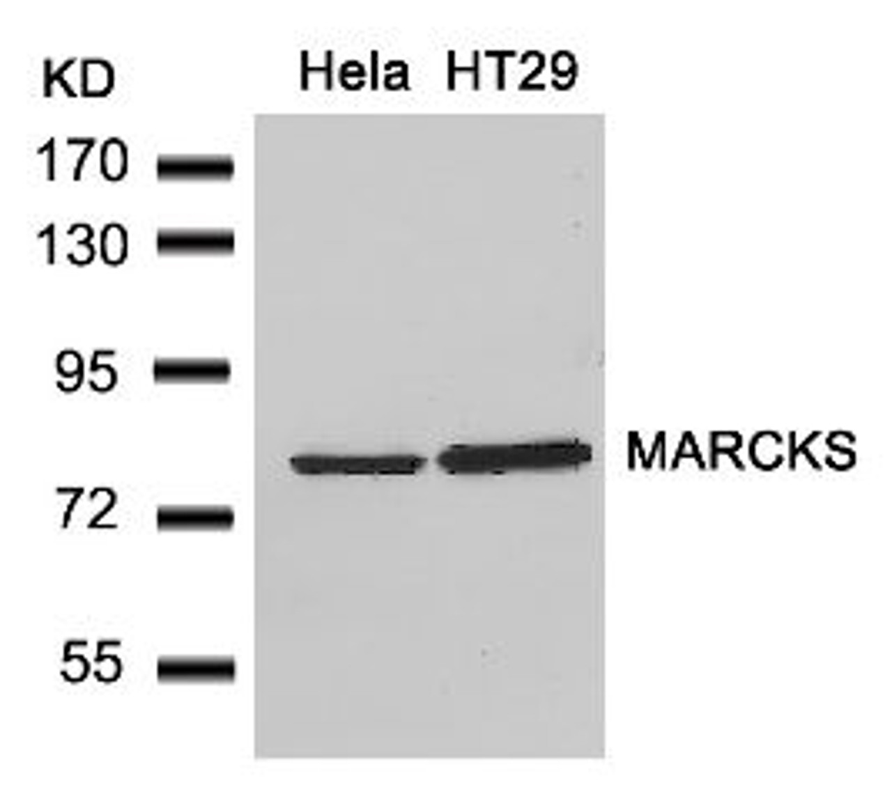 Western blot analysis of lysed extracts from HeLa and HT29 cells using MARCKS (Ab-162) .