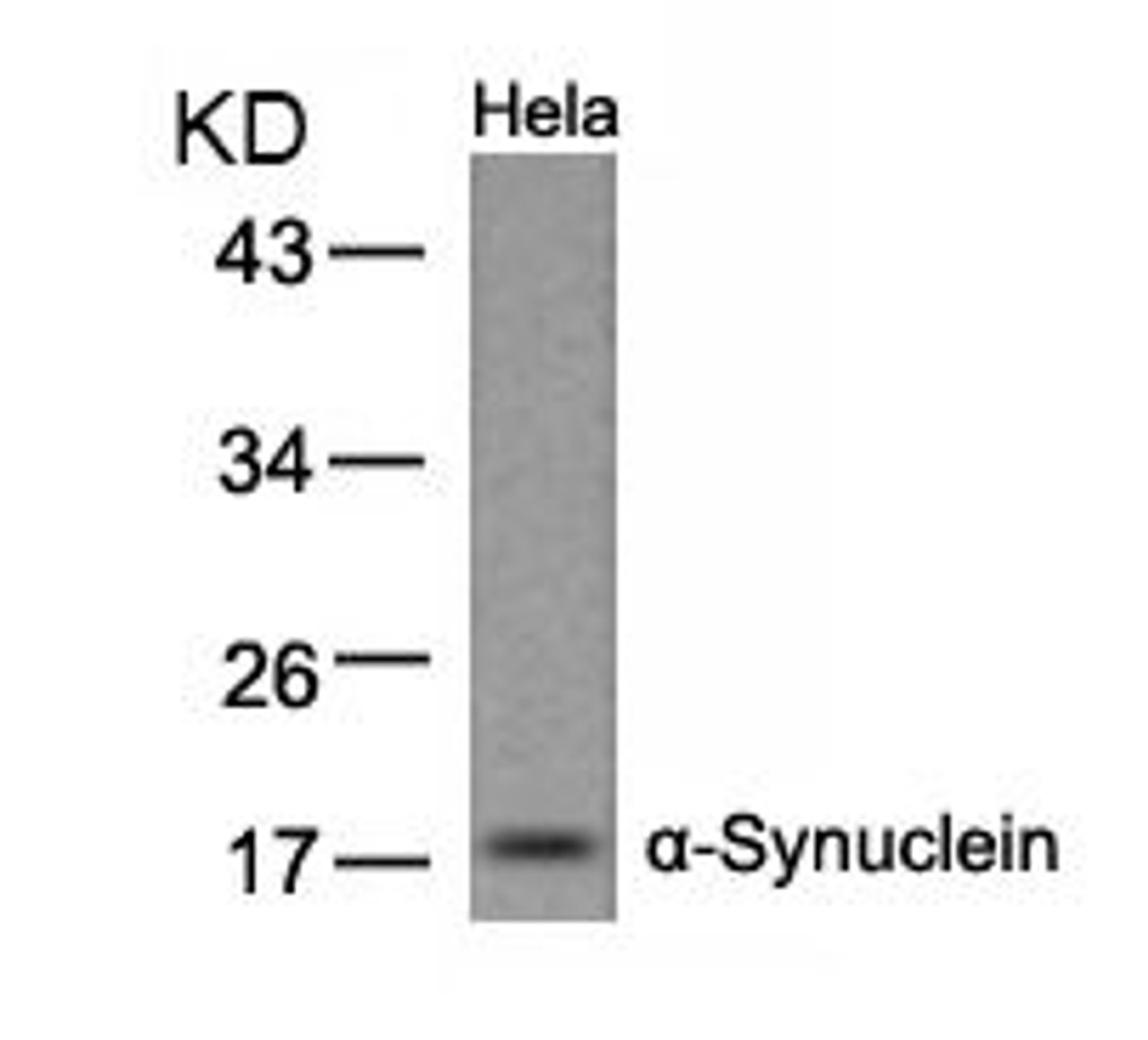 Western blot analysis of lysed extracts from HeLa cells using &#945;-Synuclein (Ab-133) .