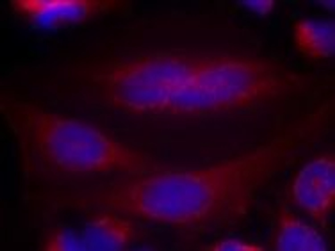 Immunofluorescence staining of methanol-fixed HeLa cells using &#945;-Synuclein (Ab-133) .
