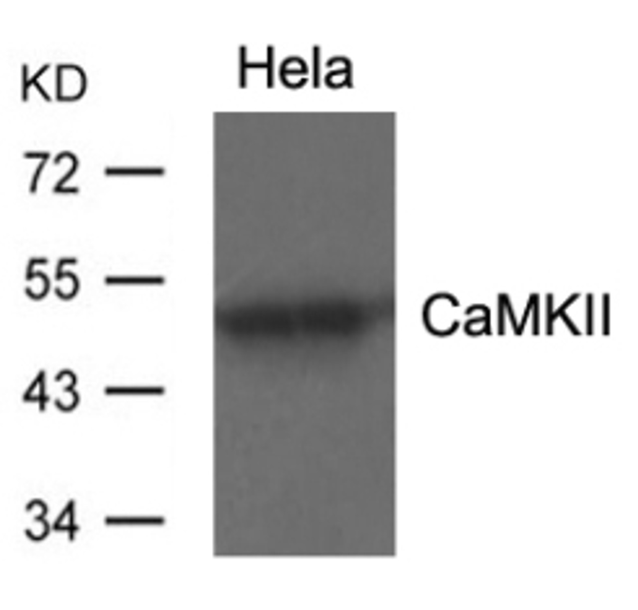 Western blot analysis of lysed extracts from HeLa using CaMKII (Ab-286) .