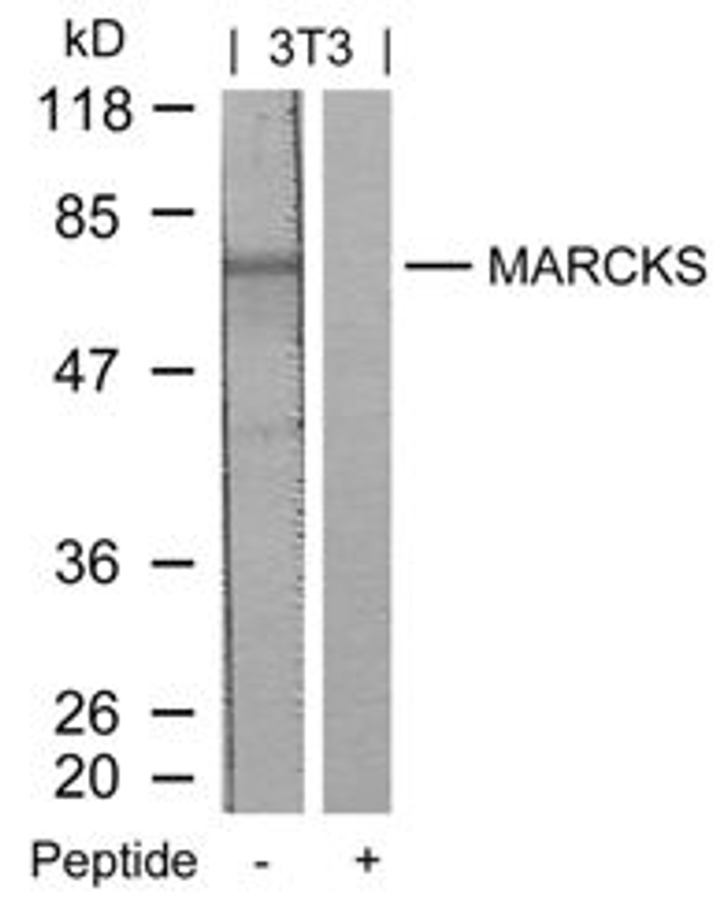 Western blot analysis of lysed extracts from 3T3 cells using MARCKS (Ab-158) .