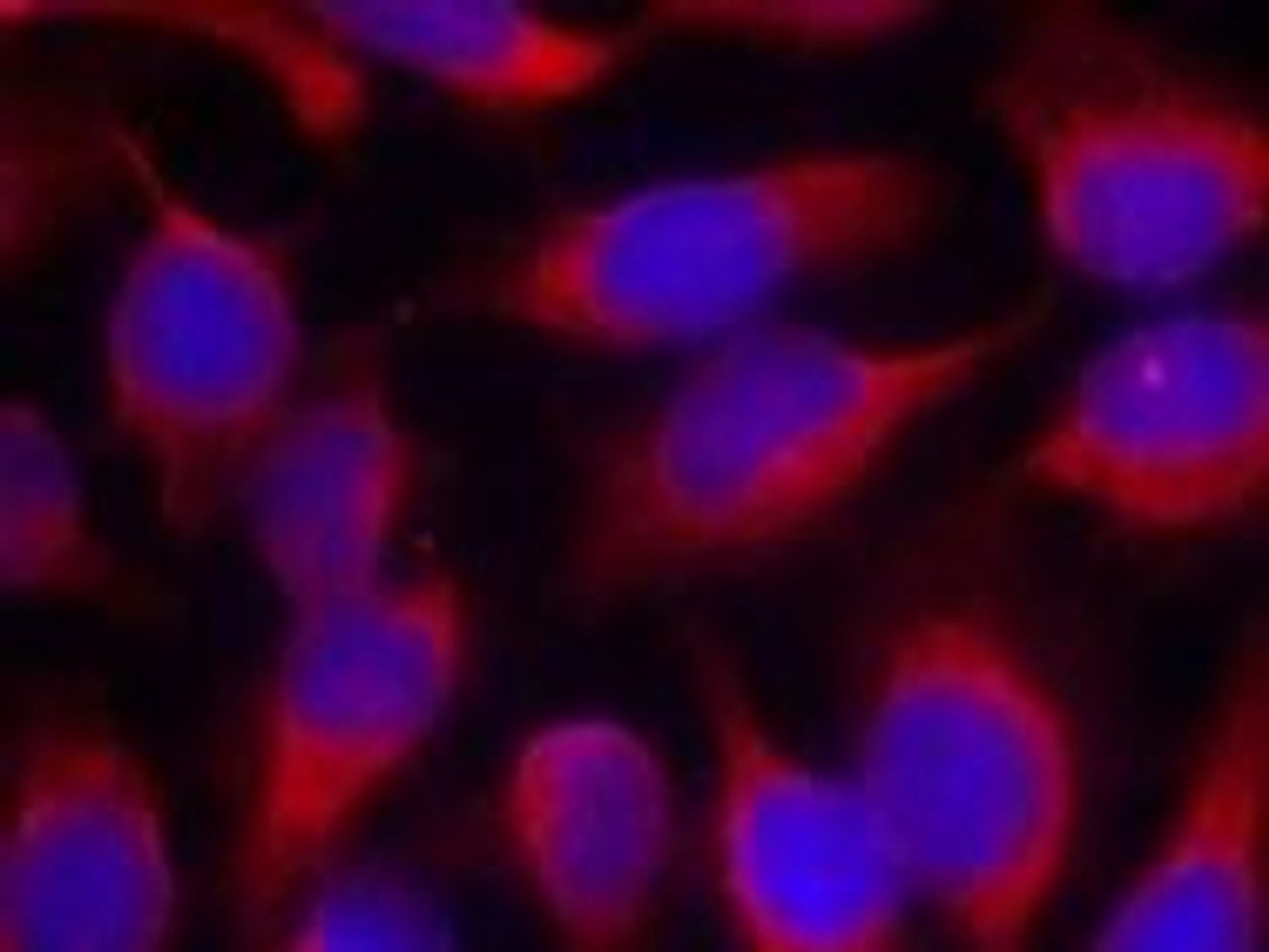Immunofluorescence staining of methanol-fixed HeLa cells using MARCKS (Ab-158) .
