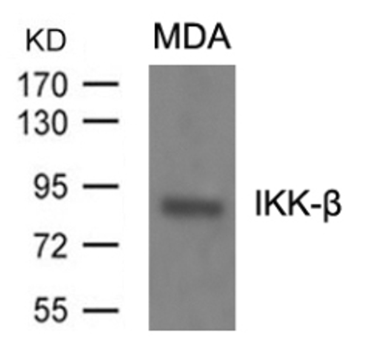 Western blot analysis of lysed extracts from MDA cells using IKK-&#946; (Ab-199) .