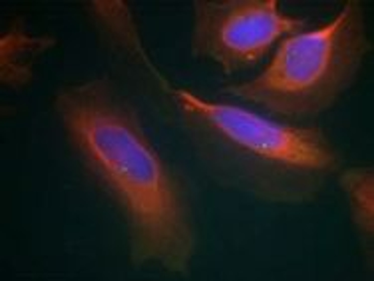 Immunofluorescence staining of methanol-fixed HeLa cells using IKK-&#946; (Ab-199) .