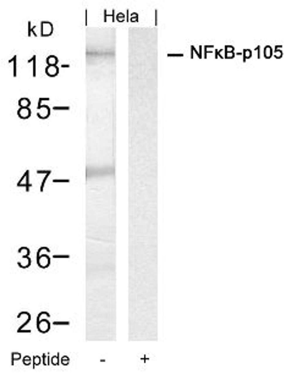 Western blot analysis of lysed extracts from HeLa cells using NF&#954;B-p105/p50 (Ab-927) .