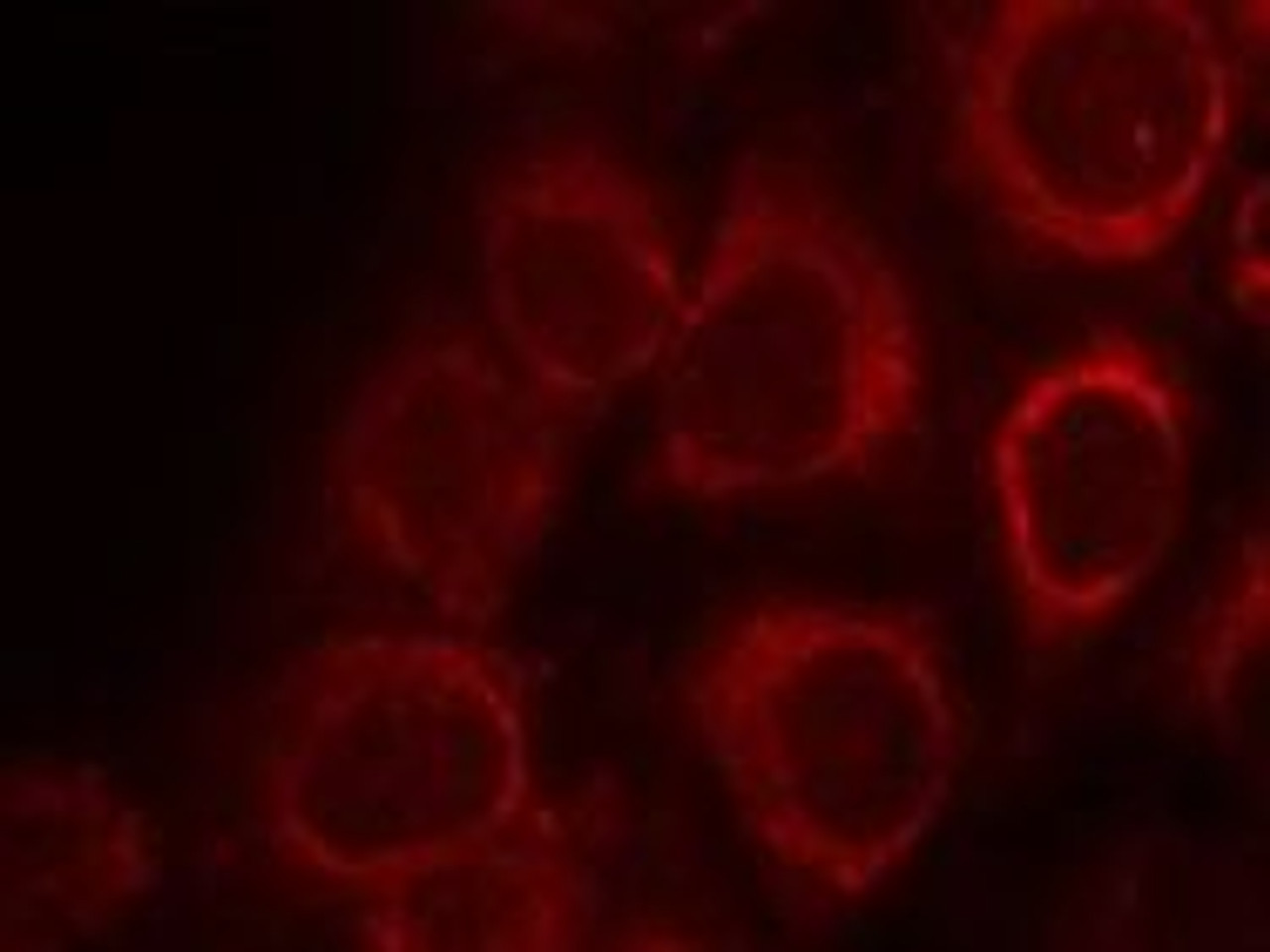 Immunofluorescence staining of methanol-fixed HeLa cells using Smad1 (Ab-465) .