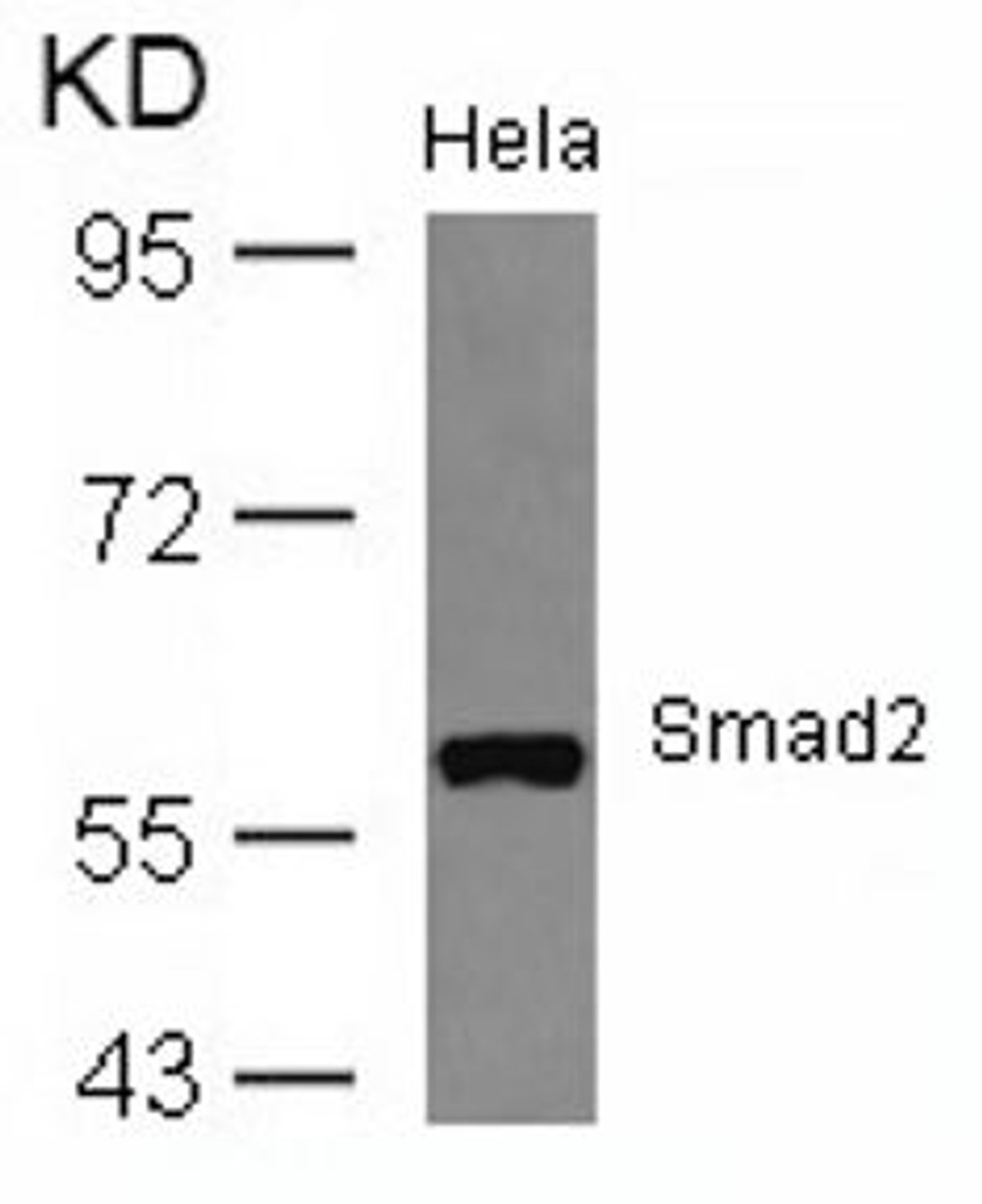 Western blot analysis of lysed extracts from HeLa cells using Smad2 (Ab-467) .