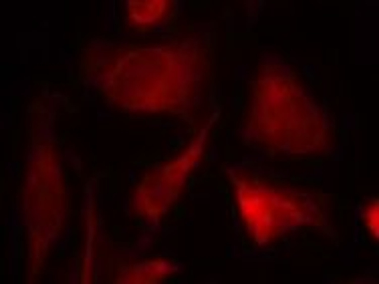 Immunofluorescence staining of methanol-fixed HeLa cells using Smad2 (Ab-467) .