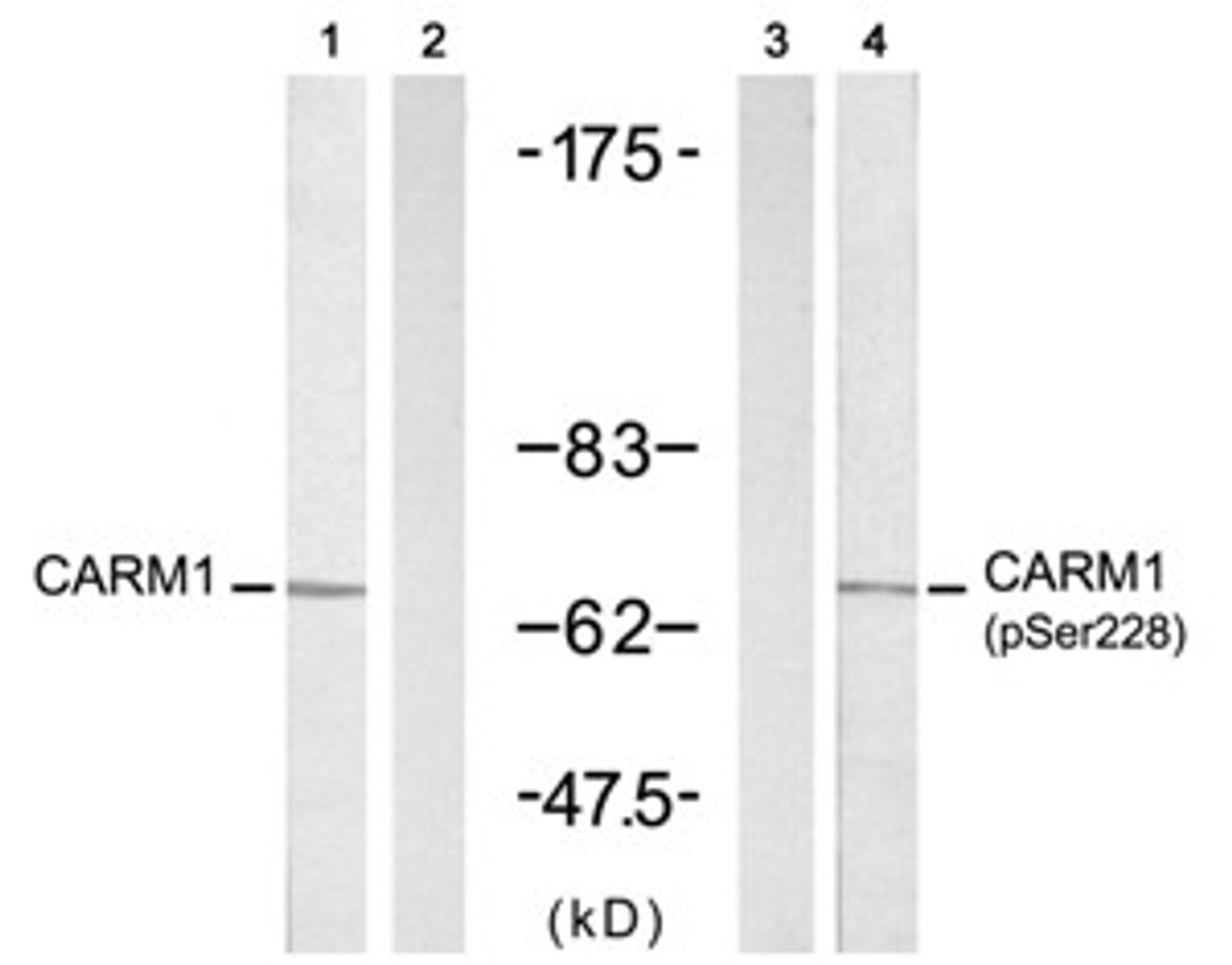 Western blot analysis of lysed extracts from A431 cells untreated or treated with EGF (200 ng/mL, 5 min) , using CARM1 (Ab-228) antibody (Line 1 and 2) and CARM1 (Phospho-Ser228) antibody (Line 3 and 4) .