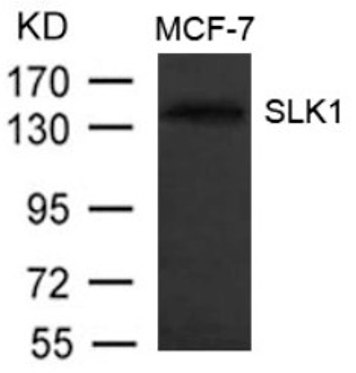 Western blot analysis of extract from MCF-7 cells using SLK1 Antibody.