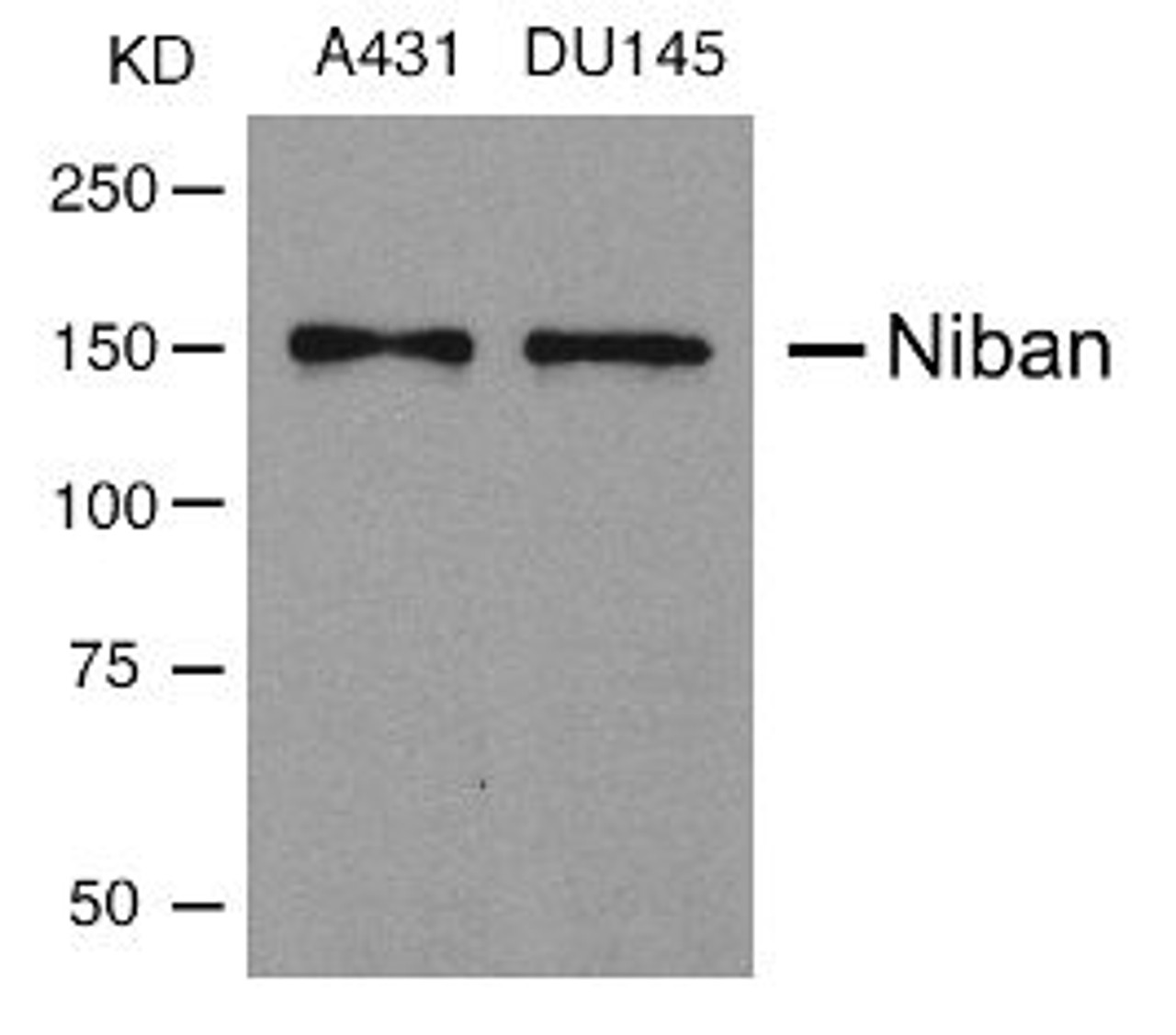 Western blot analysis of lysed extracts from A431 and DU145 cells using Niban Antibody.