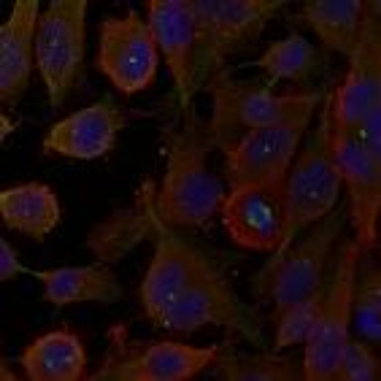 Immunofluorescence staining of methanol-fixed HeLa cells using LC3A antibody #21402.