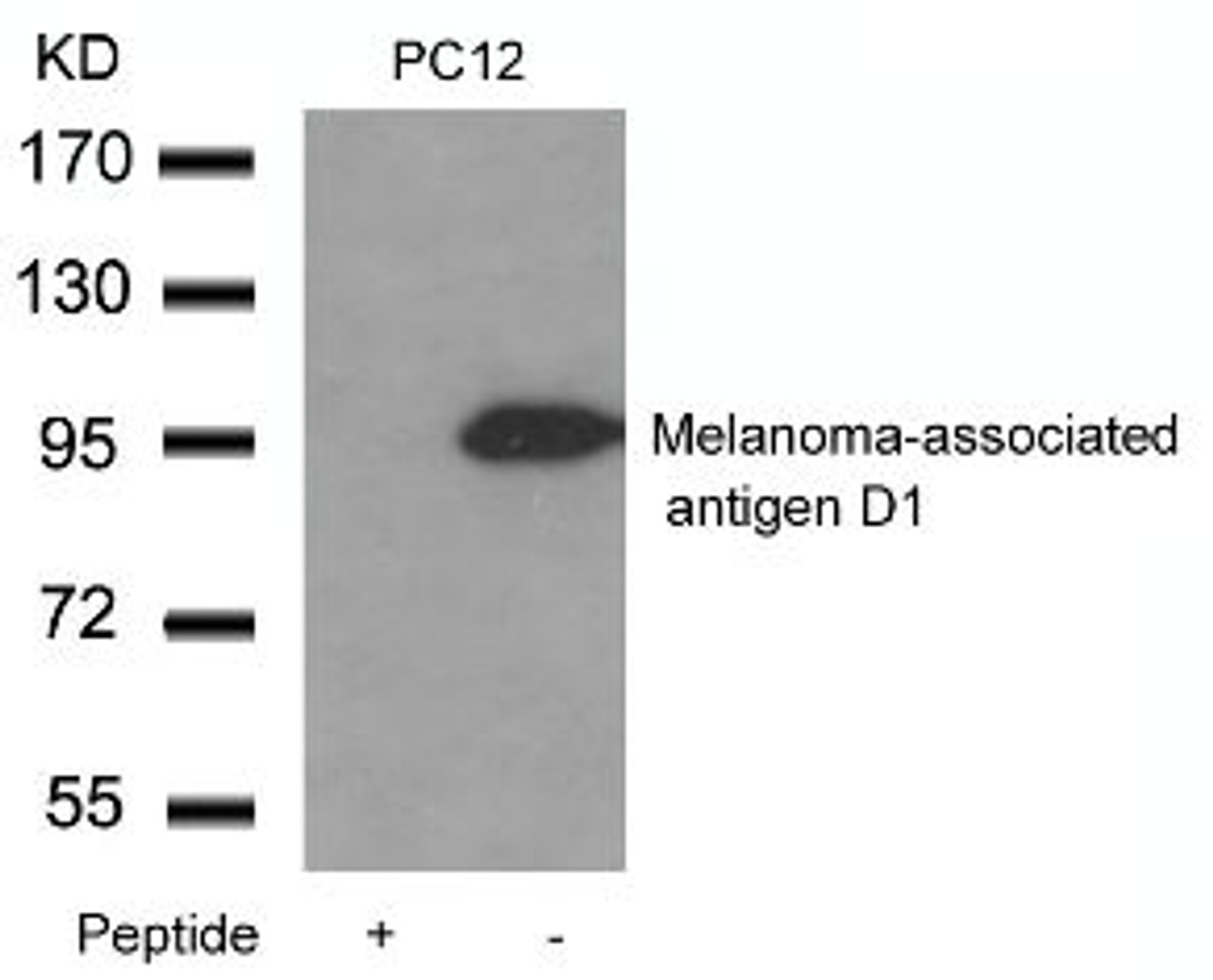 Western blot analysis of lysed extracts from PC12 cells using Melanoma-associated antigen D1 Antibody.