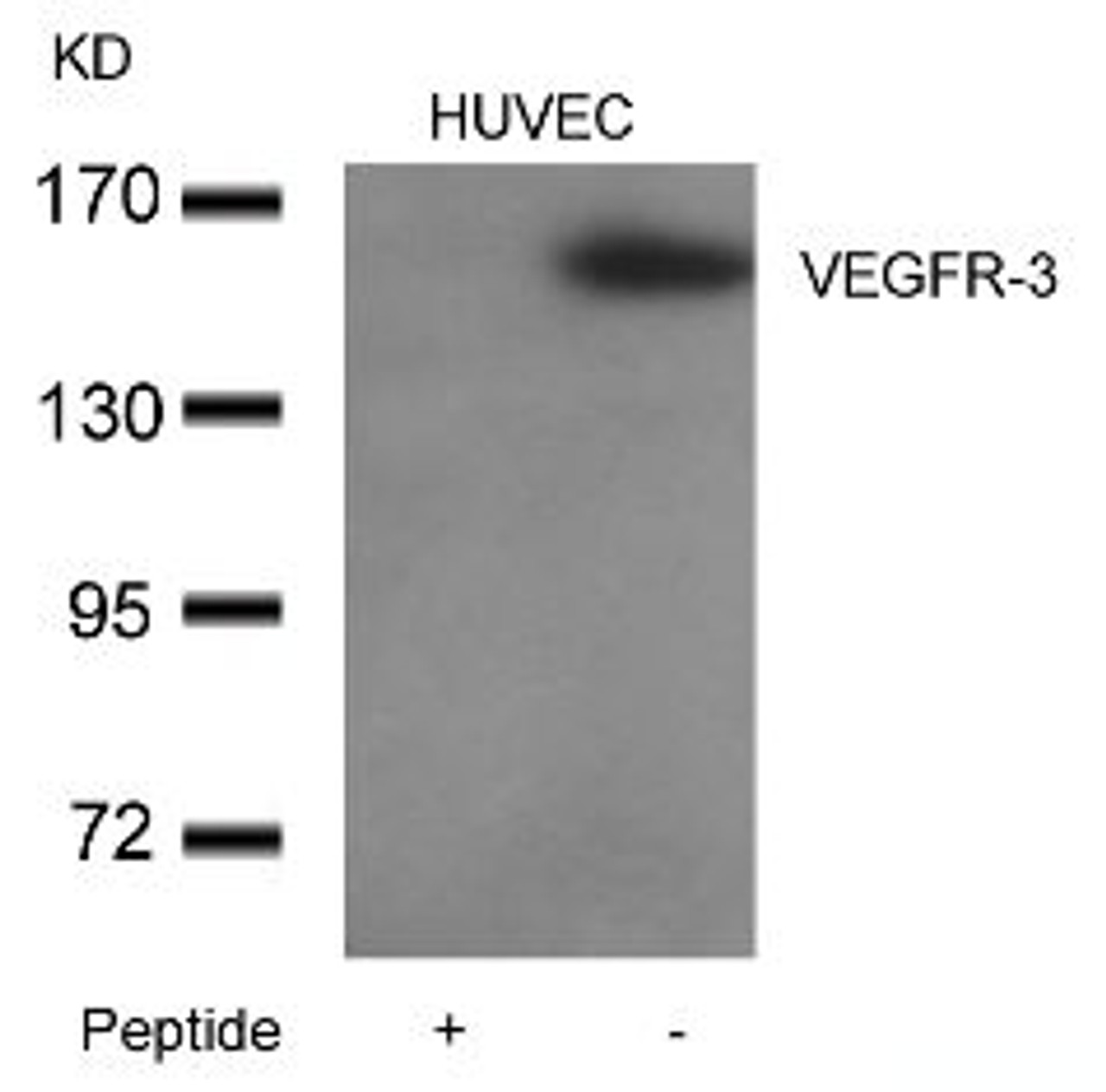 Western blot analysis of lysed extracts from HUVEC cells using VEGFR-3 Antibody.