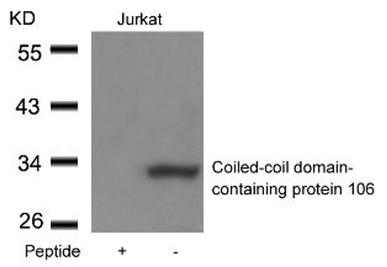 Western blot analysis of lysed extracts from Jurkat cells using Coiled-coil domain-containing protein 106 Antibody.