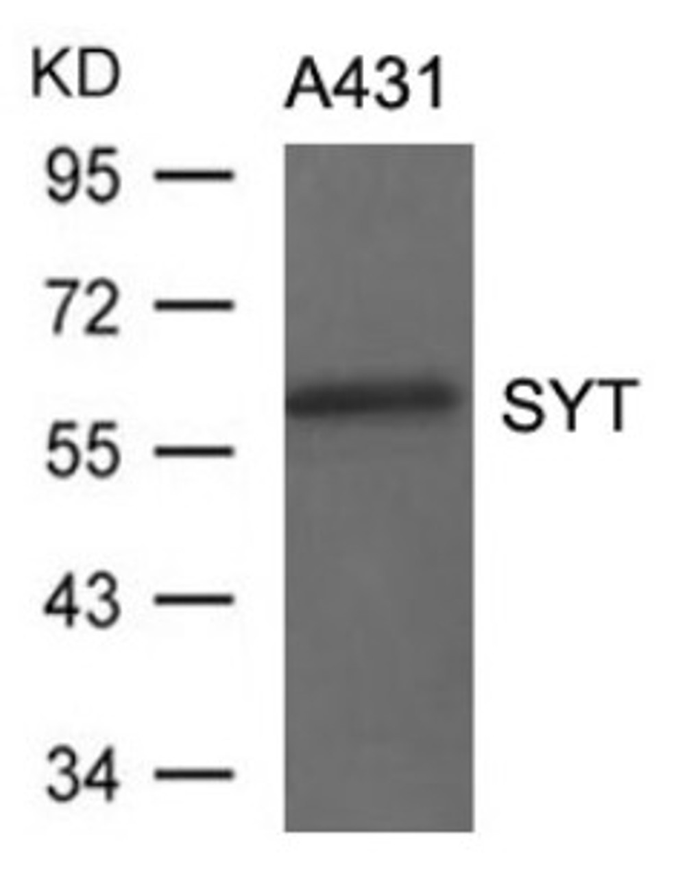 Western blot analysis of lysed extracts from A431 cells using SYT Antibody.