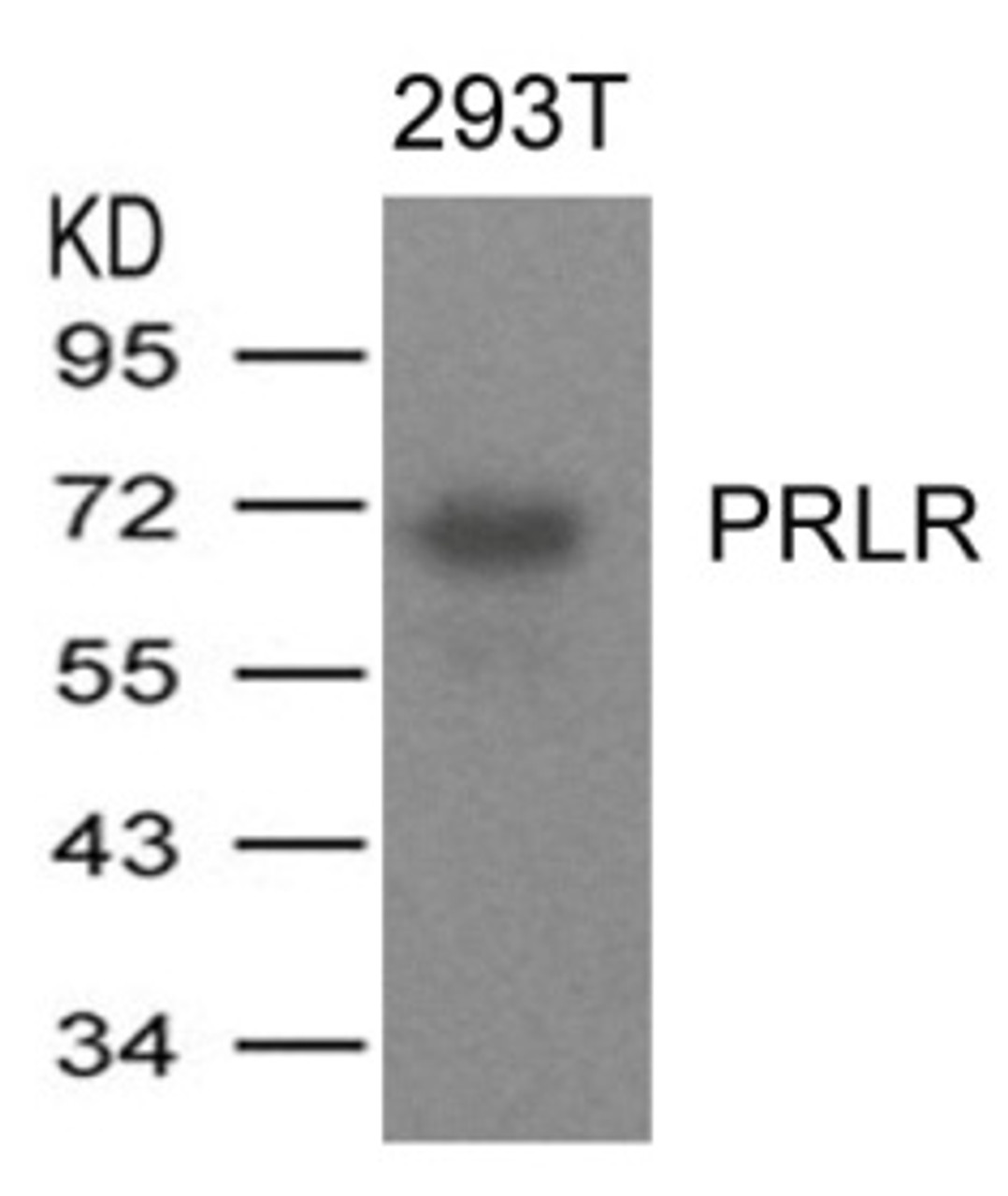 Western blot analysis of lysed extracts from 293T cells expressing human PRLR protein using PRLR Antibody.