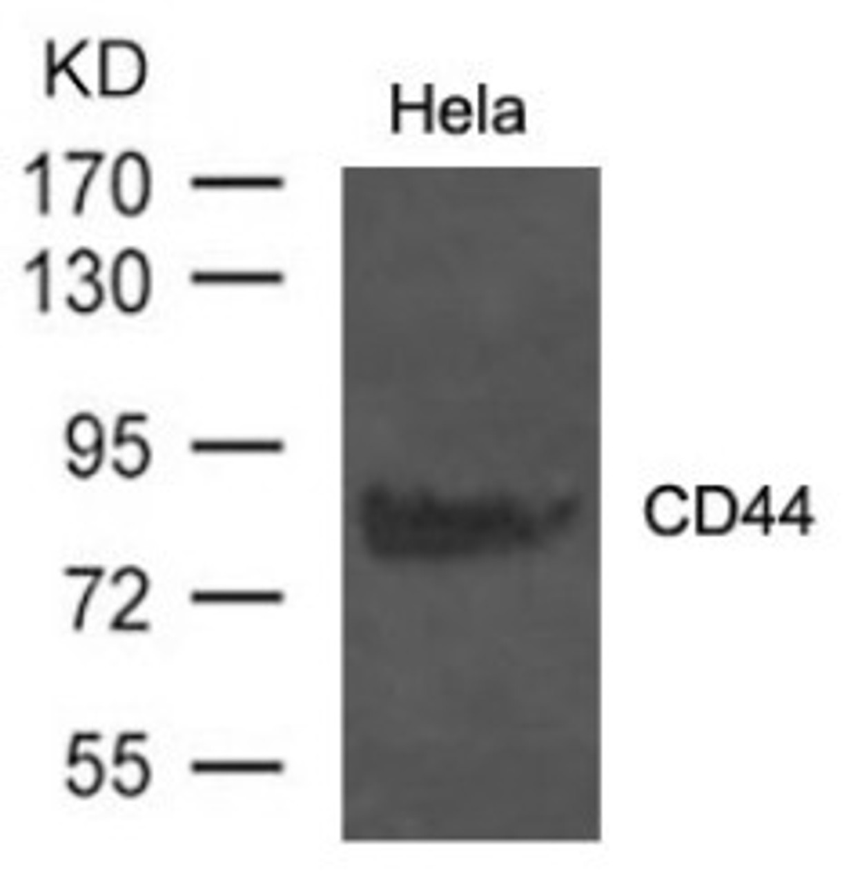 Western blot analysis of extract from HeLa cells using CD44 Antibody.