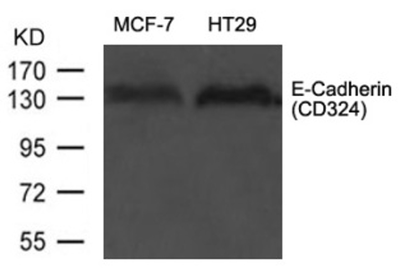 Western blot analysis of extract from MCF-7 and HT29 cells using E-Cadherin (CD324) .