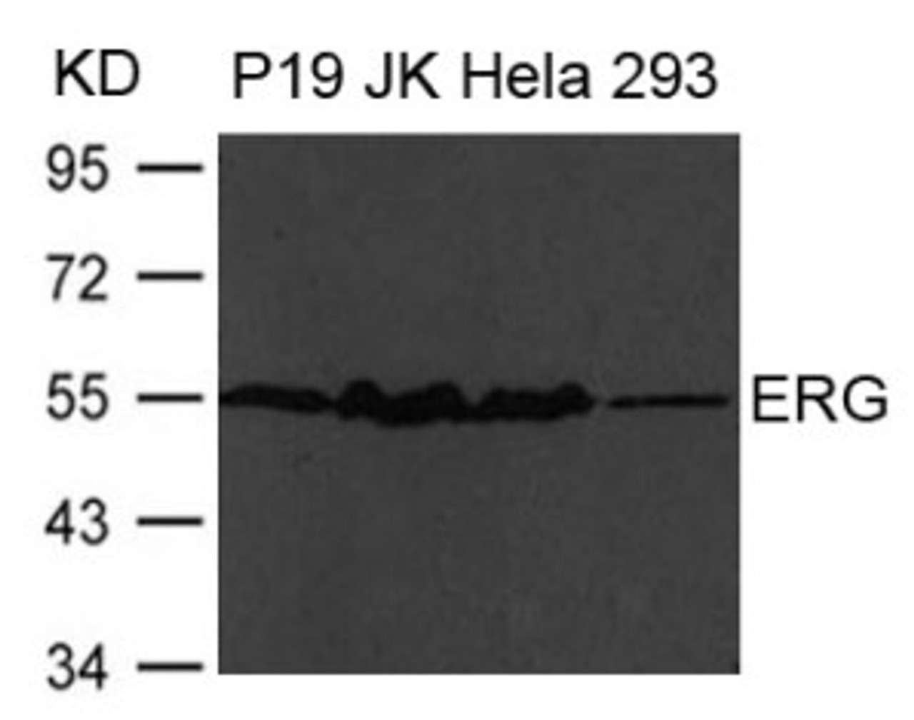 Western blot analysis of extract from P19, JK, HeLa and 293 cells using ERG Antibody.