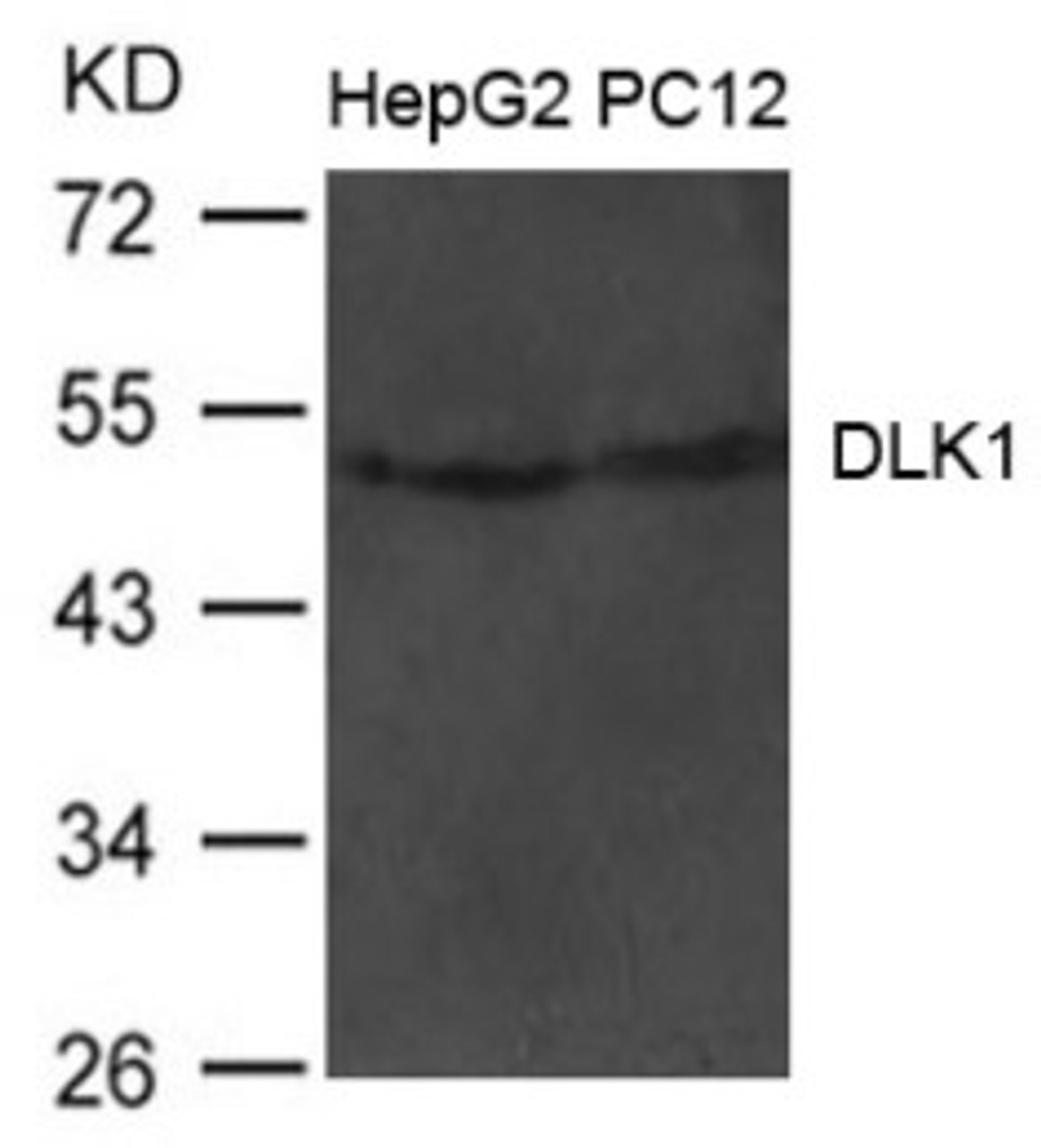 Western blot analysis of extract from HepG2 and PC12 cells using DLK1 Antibody.