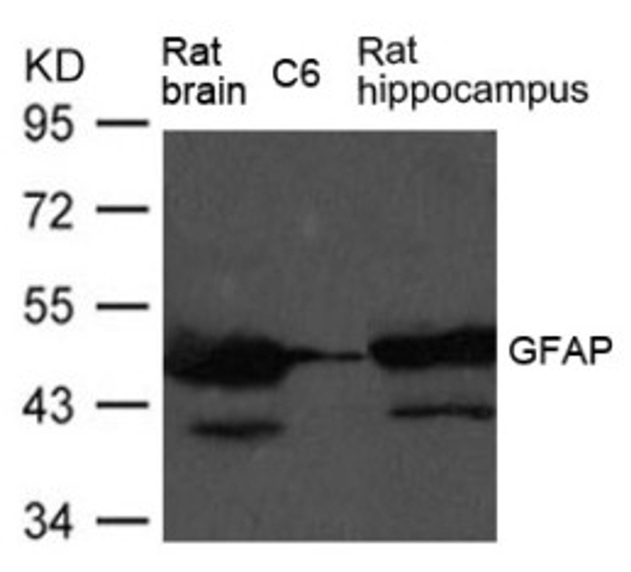 Western blot analysis of extract from Rat brain, Rat hippocampus tissue and C6 cells using GFAP Antibody.