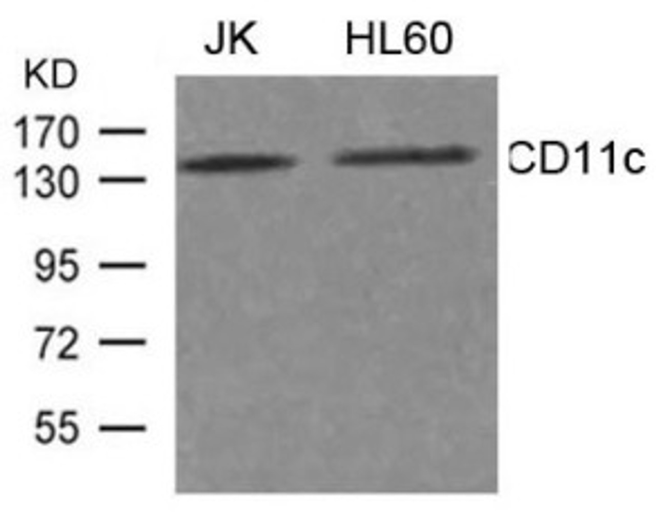 Western blot analysis of extract from JK, HL-60 cells using CD11c Antibody.