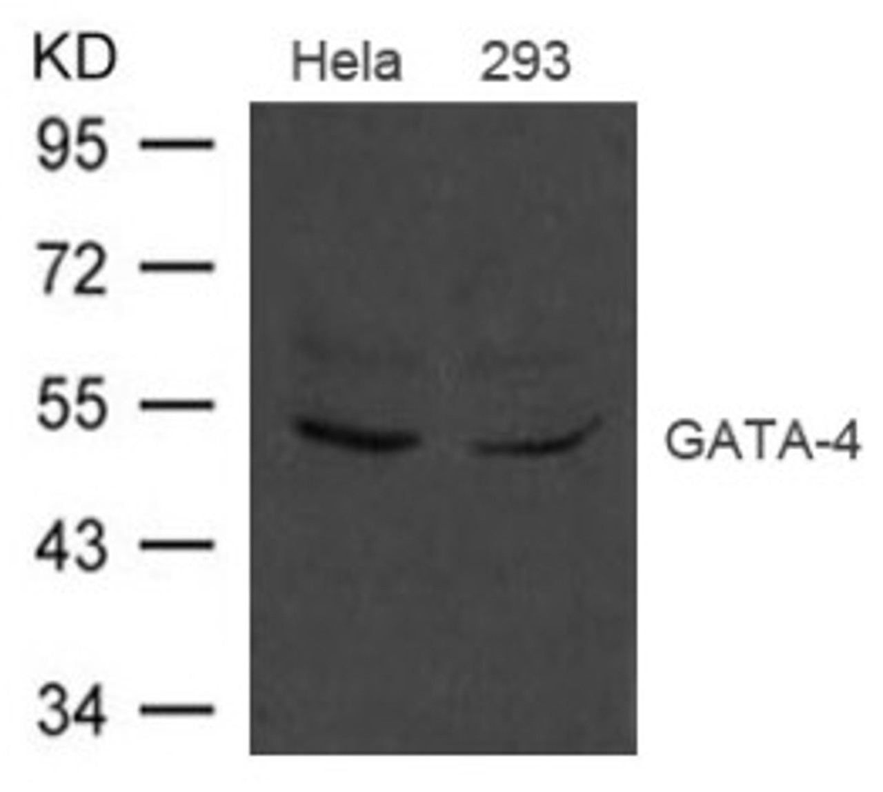 Western blot analysis of extract from HeLa and 293 cells using GATA-4 Antibody.