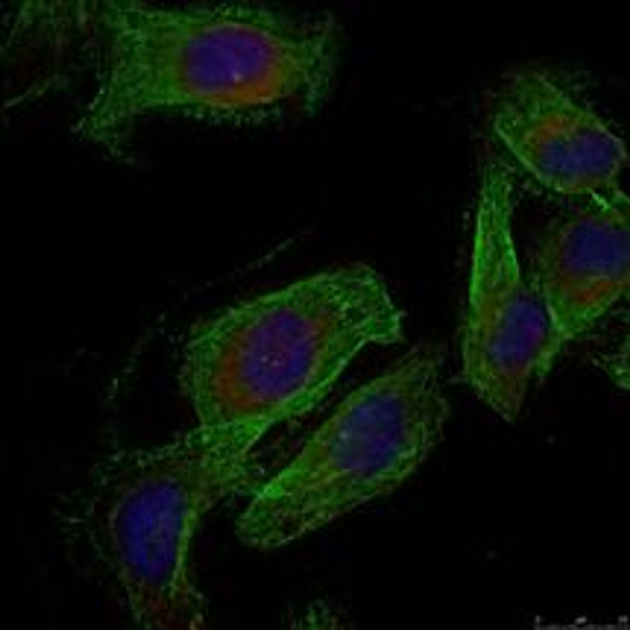 Immunofluorescence staining of methanol-fixed HeLa cells using Paxillin (Ab-88) .