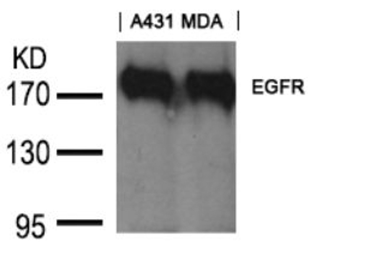 Western blot analysis of lysed extracts from A431 and MDA cells using EGFR (Ab-1197) goat polyclonal Antibody.