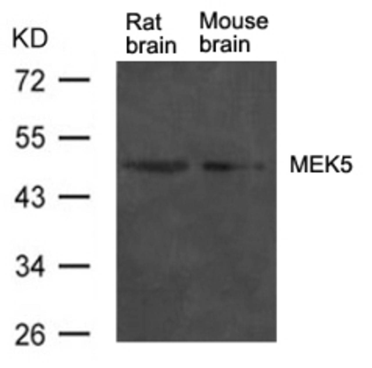 Western blot analysis of extract from rat brain and mouse brain tissue using MEK5 Antibody.