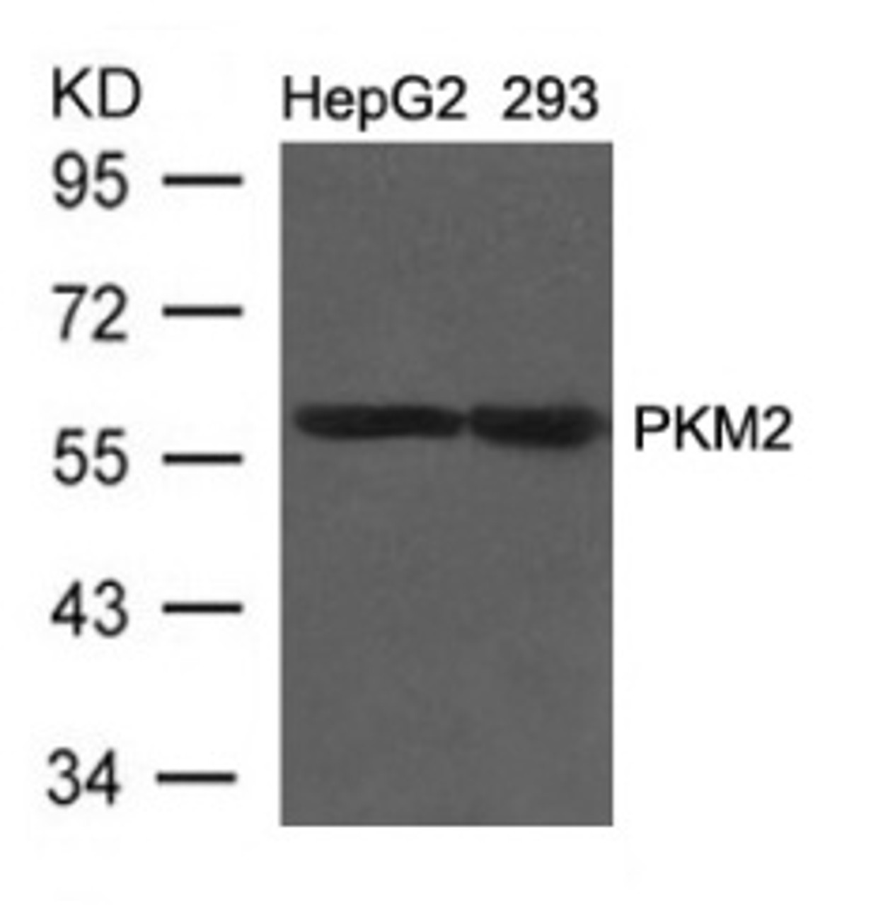 Western blot analysis of lysed extracts from HepG2 and 293 cells using PKM1/2 Antibody.