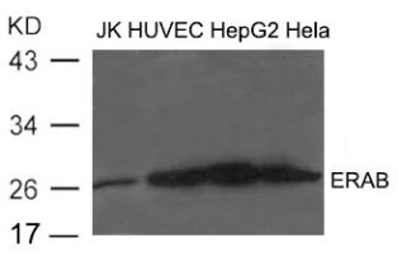 Western blot analysis of extract from JK, HUVEC, HepG2 and HeLa cells using ERAB Antibody.