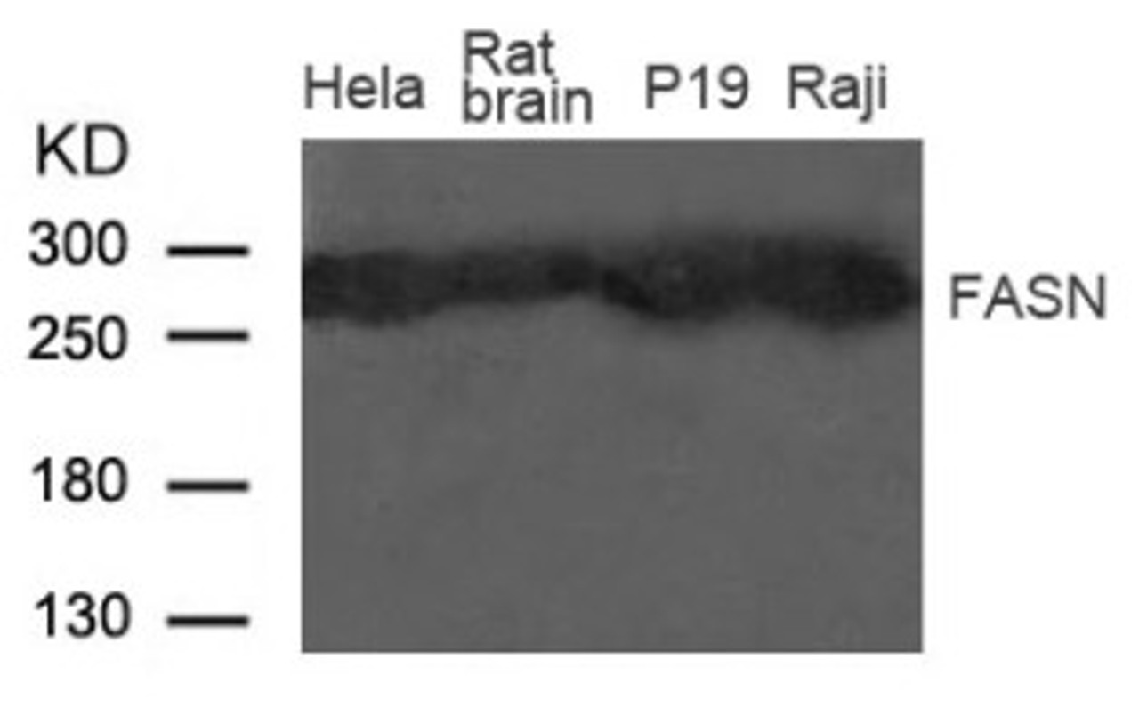 Western blot analysis of extract from Rat brain tissue, HeLa, Raji, P19 cells using Fatty Acid Synthase (FASN) .