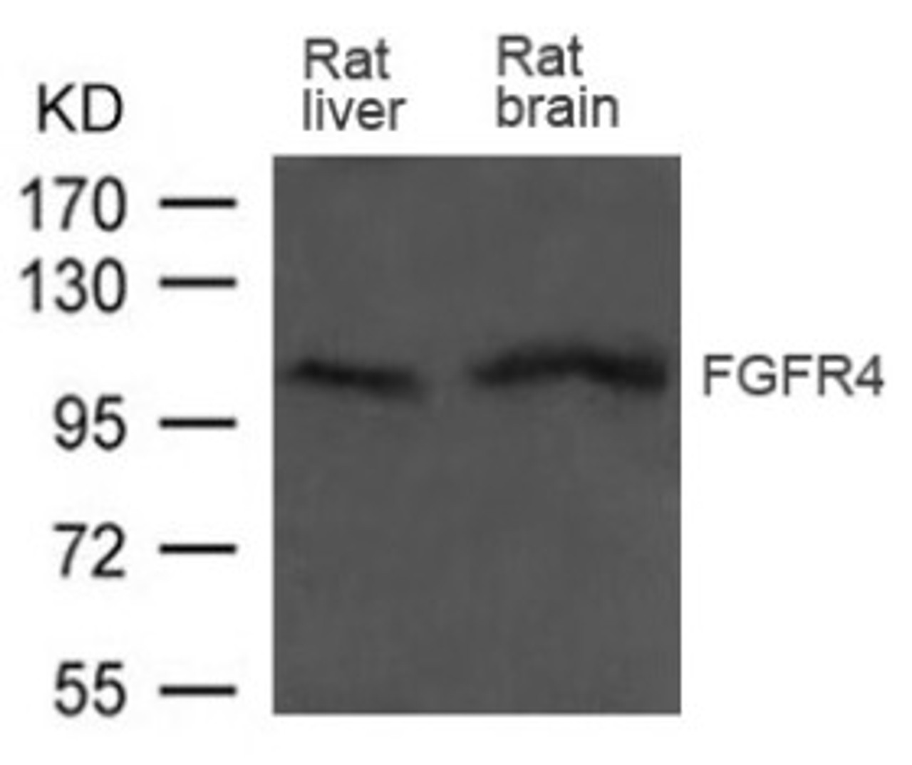 Western blot analysis of extract from Rat liver and Rat brain tissue using FGFR4 Antibody.