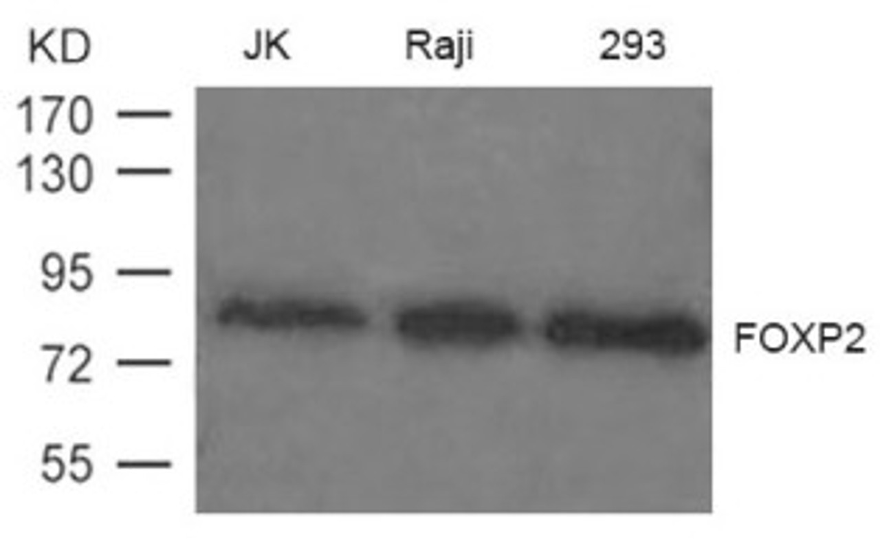 Western blot analysis of extract from JK, Raji and 293 cells using FOXP2 Antibody.