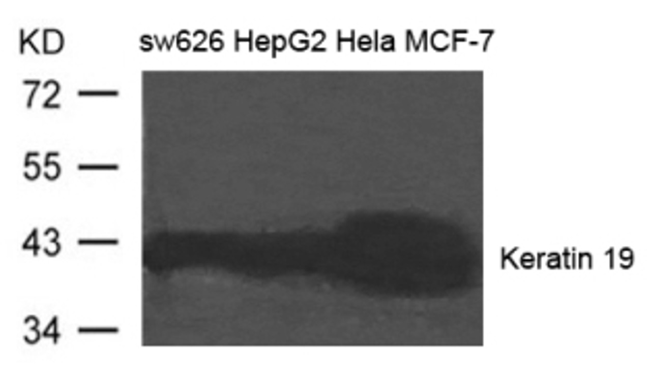 Western blot analysis of extract from SW626, HepG2, HeLa and MCF-7 cells using Keratin 19 Antibody.