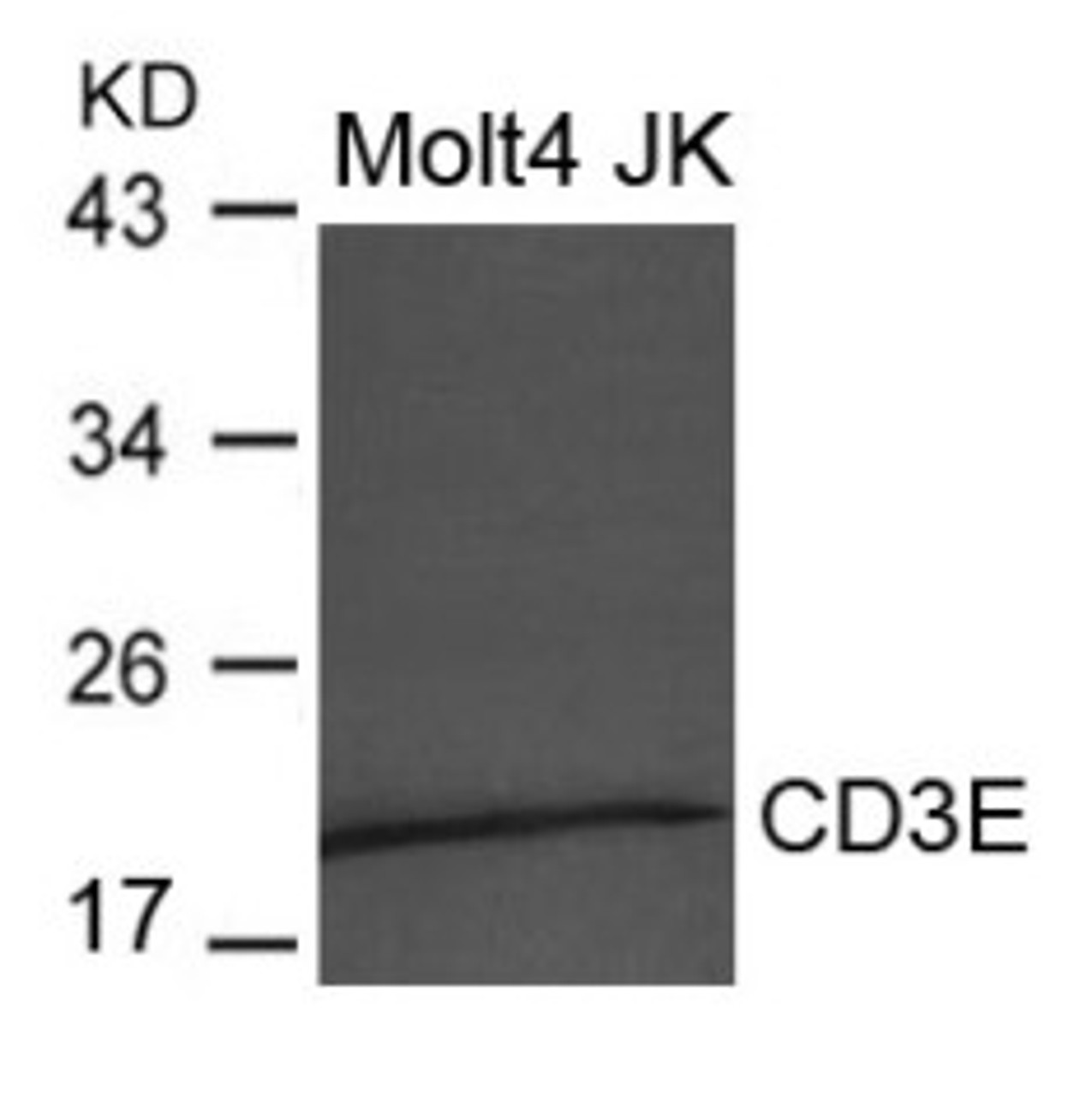 Western blot analysis of extract from Molt4 and JK cells using CD3E Antibody.