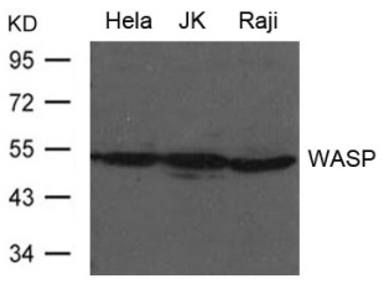 Western blot analysis of extract from HeLa, JK and Raji cells using WASP Antibody.