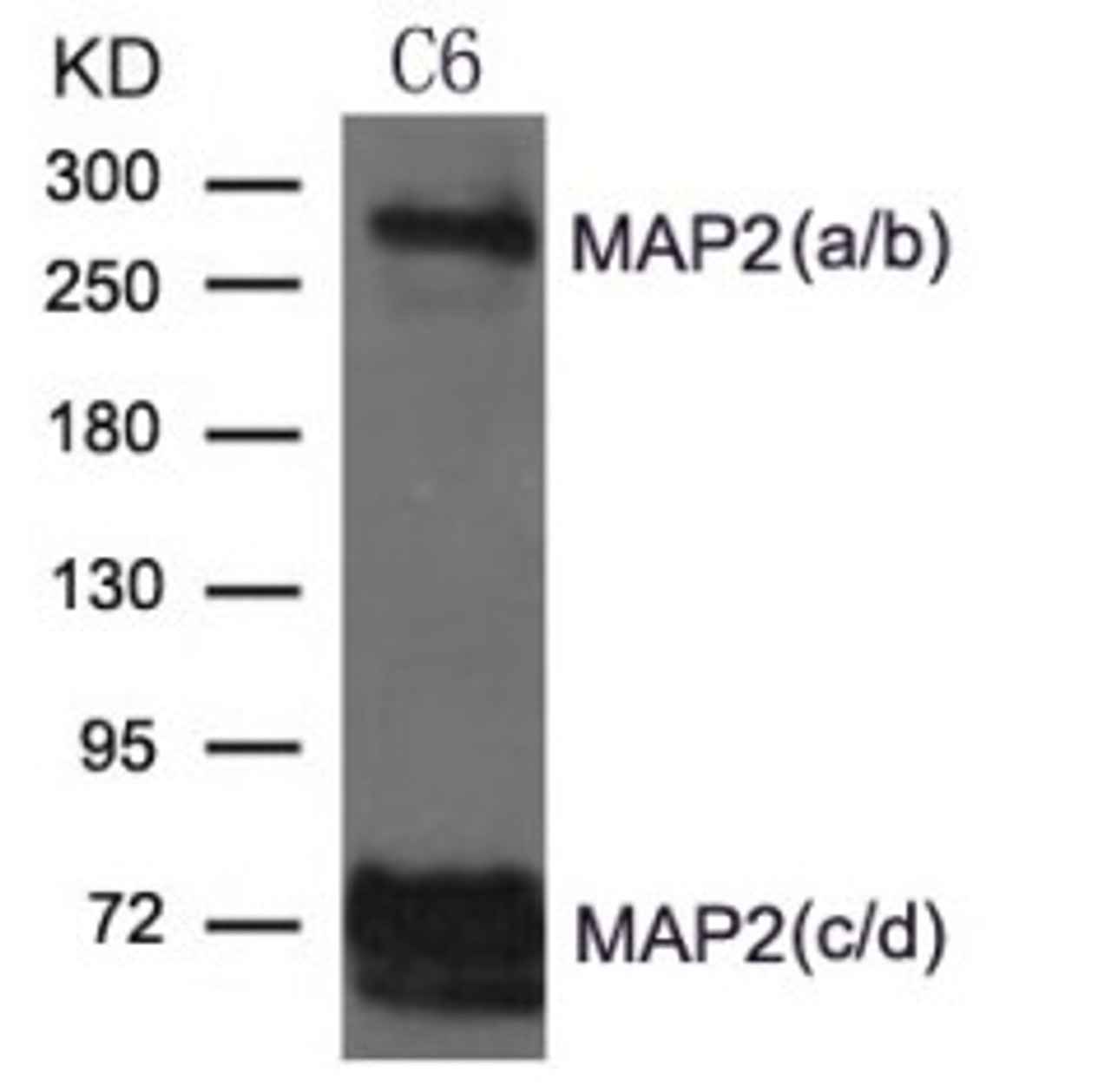 Western blot analysis of extract from Rat brain and Mouse brain Tissue using MAP2 Antibody.