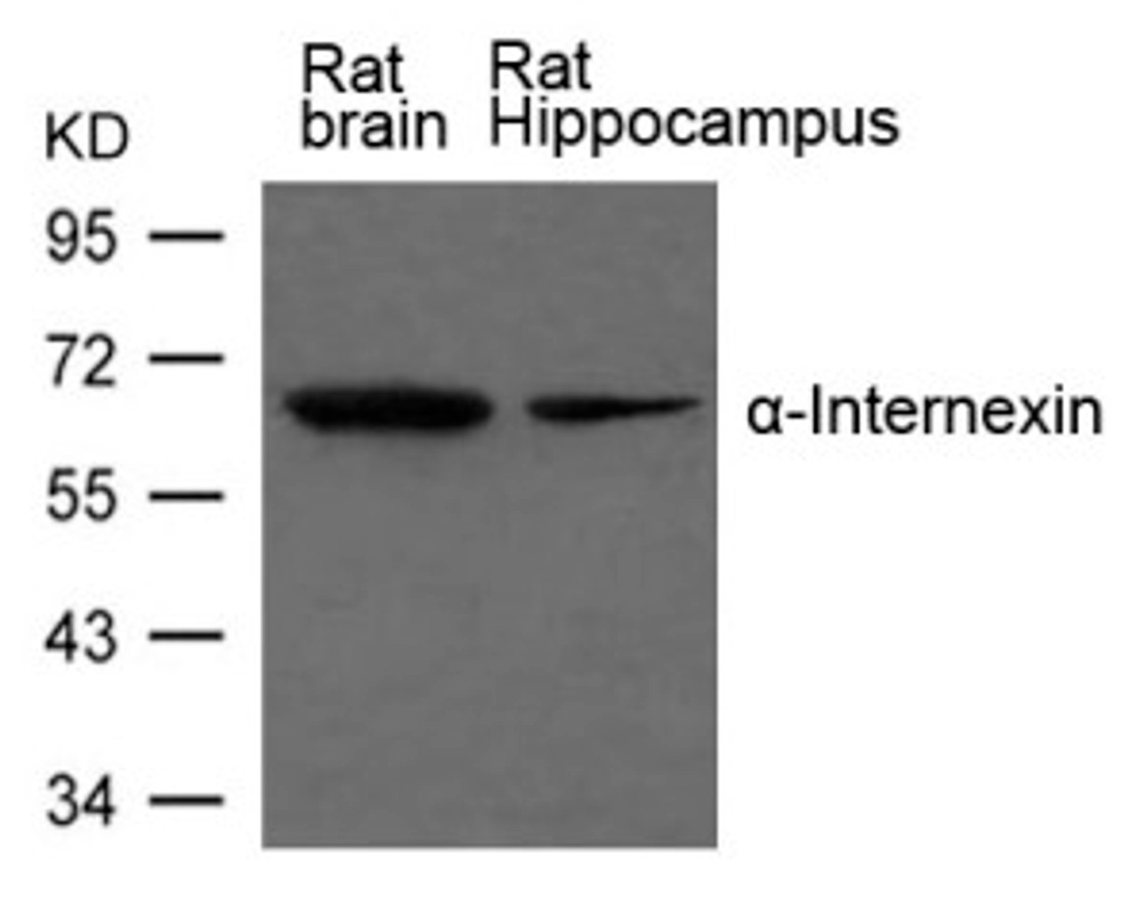 Western blot analysis of extract from Rat brain and Rat hippocampus Tissue using &#945;-Internexin Antibody.