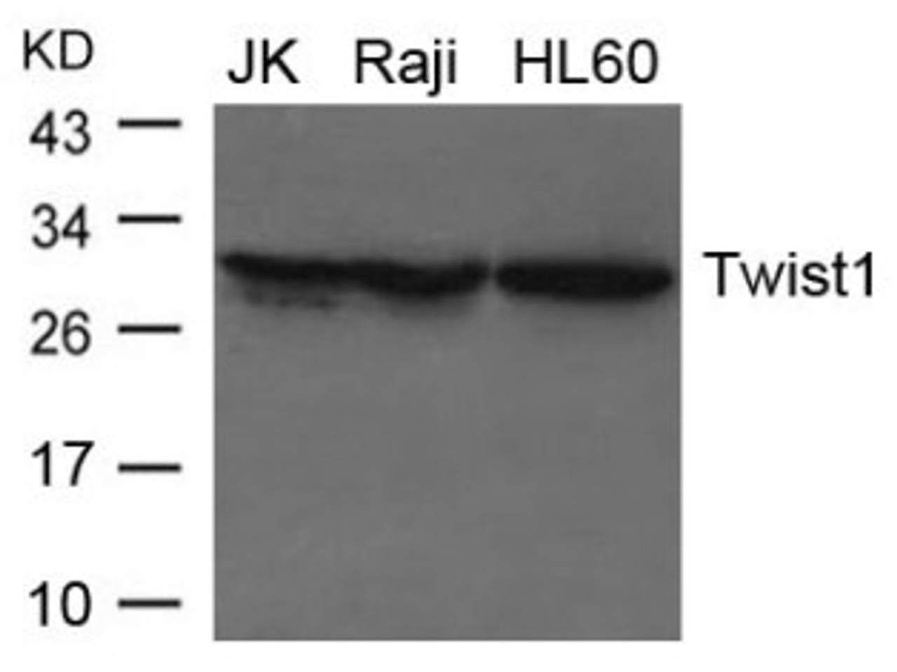 Western blot analysis of lysed extracts from JK, Raji and HL-60 cells using Twist1 Antibody.