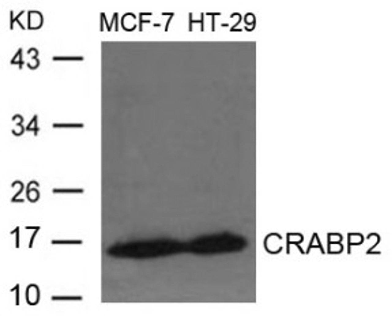 Western blot analysis of lysed extracts from MCF-7 and HT-29 cells using CRABP2 Antibody.