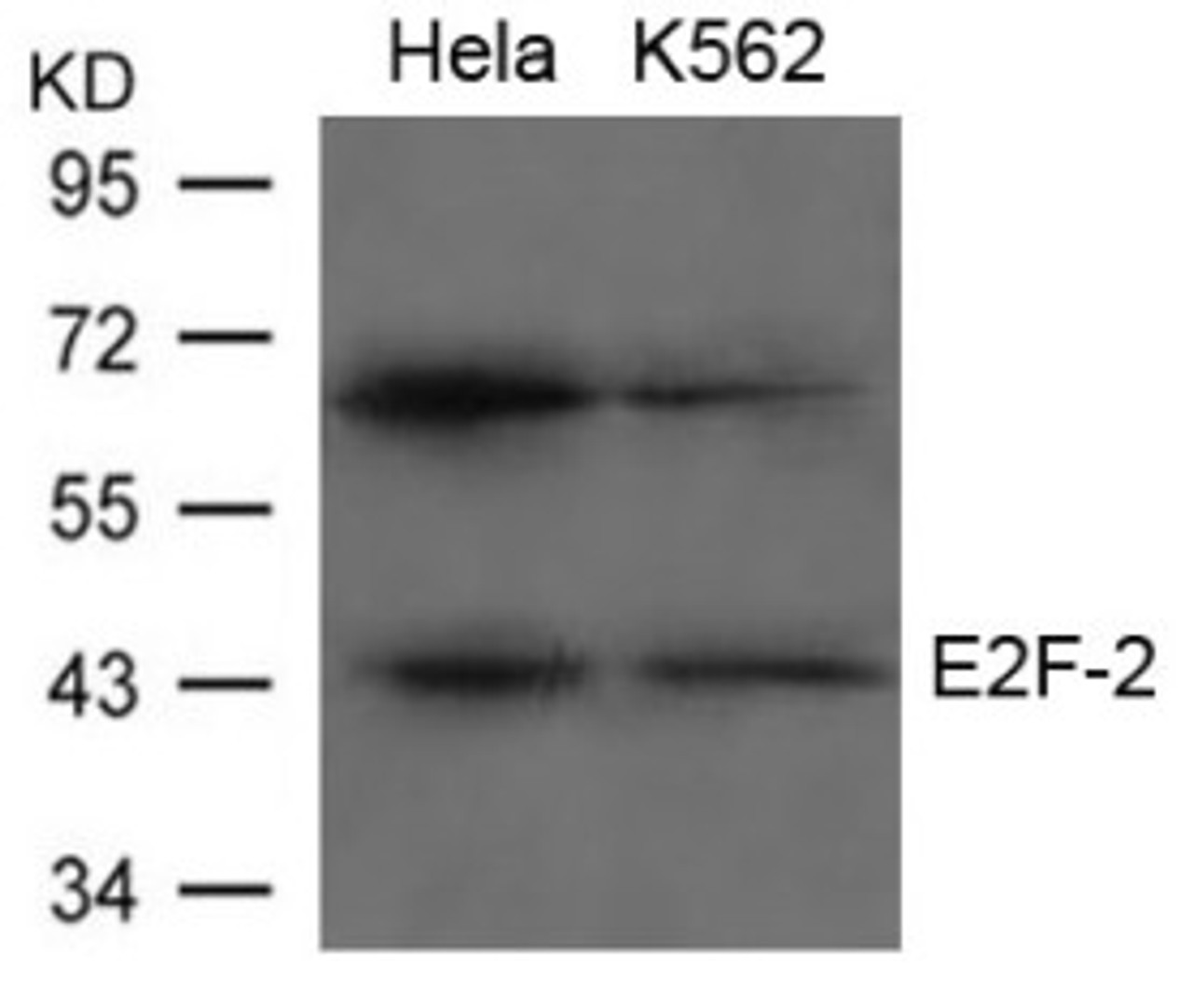 Western blot analysis of lysed extracts from HeLa and K562 cells using E2F-2 Antibody.